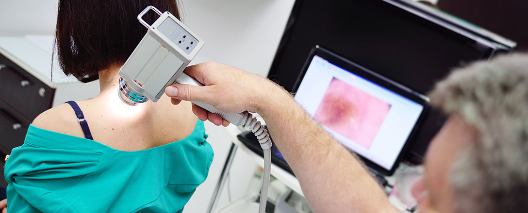 Hautkrebsdiagnostik