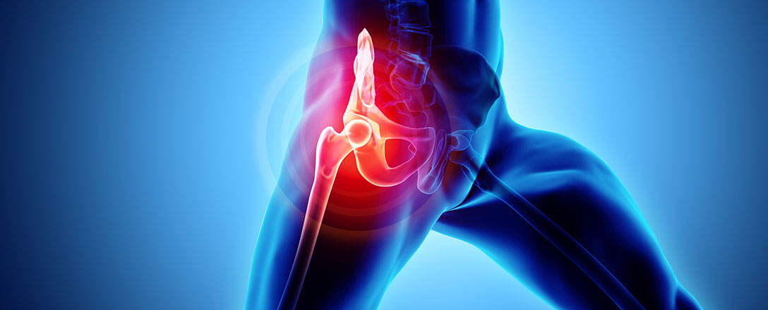 Neue Technologien bei Gelenksersatz-OPs